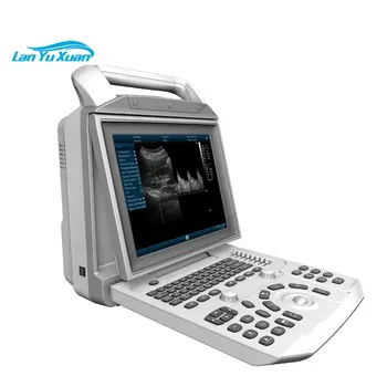 Четкое изображение Полностью Цифровая Китайская Портативная ультразвуковая сканирующая машина Медицинская Цена